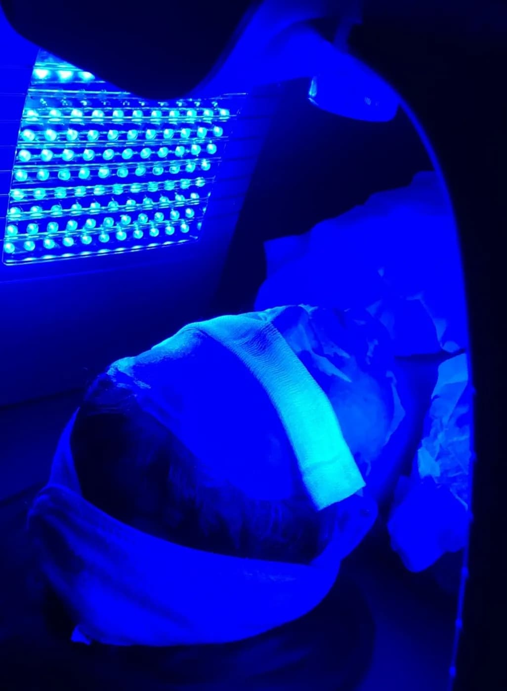 HydraFacial at B.Star Aesthetic Clinic, DHA Phase 5 Karachi
