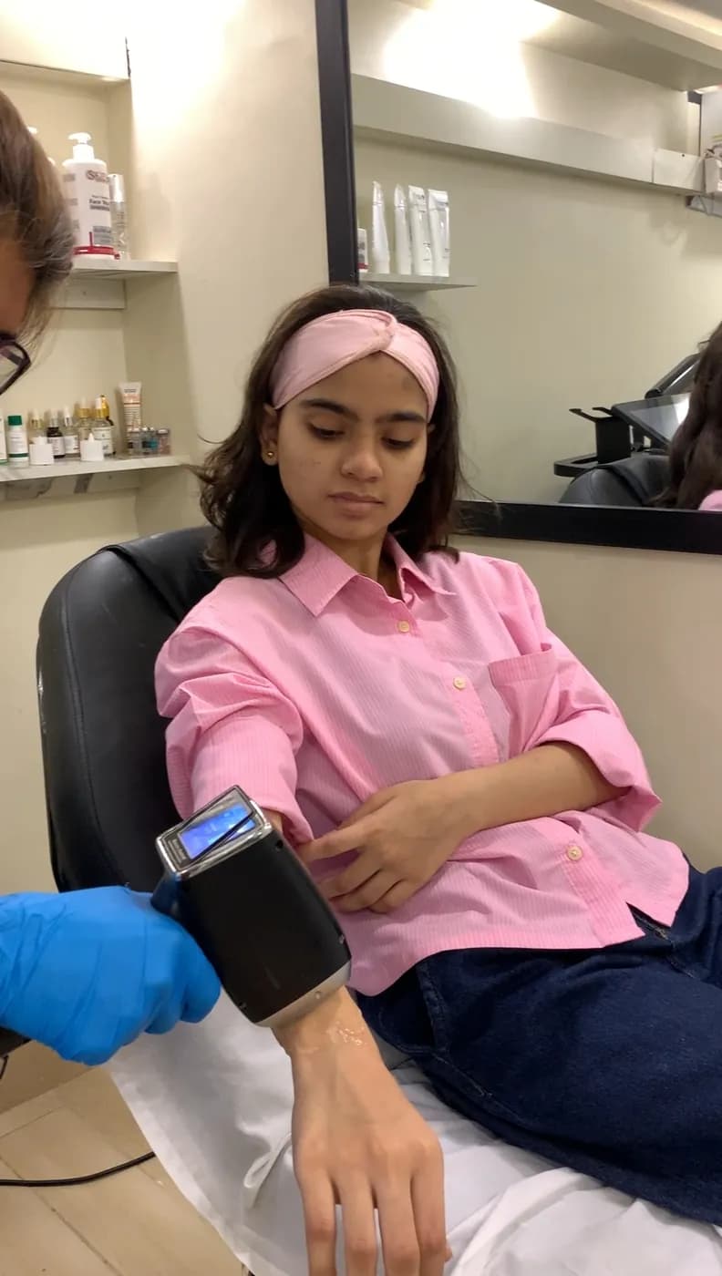 Client receiving Soprano Titanium laser hair removal at B.Star Aesthetic Clinic